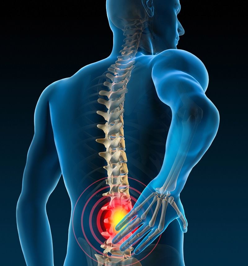 Lower Back Pain  Central Health Physiotherapy