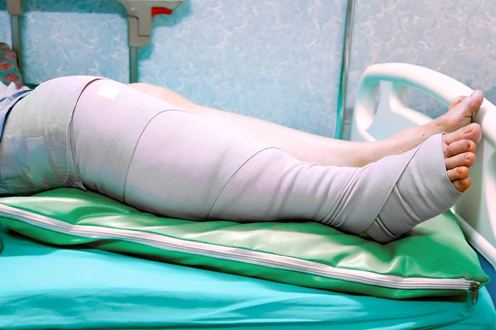 photo of a leg with bandage after surgical operation knee in the hospital