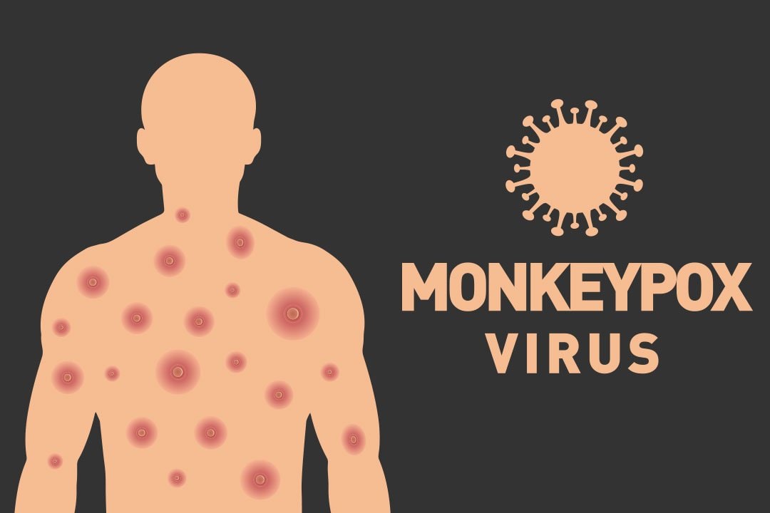 graphic of Monkeypox virus