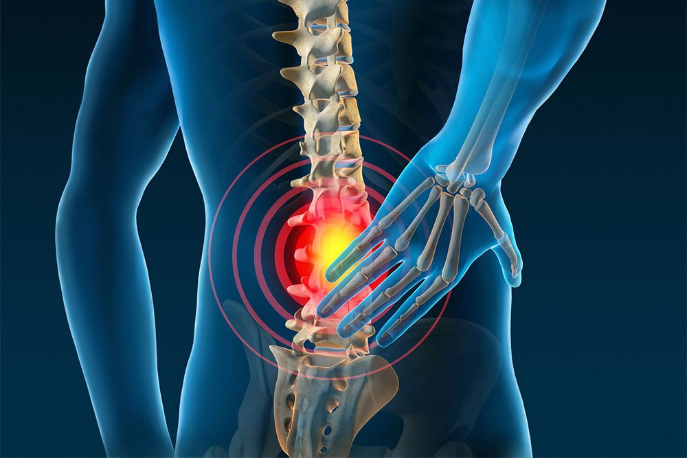 graphic of an anatomy of a man's back